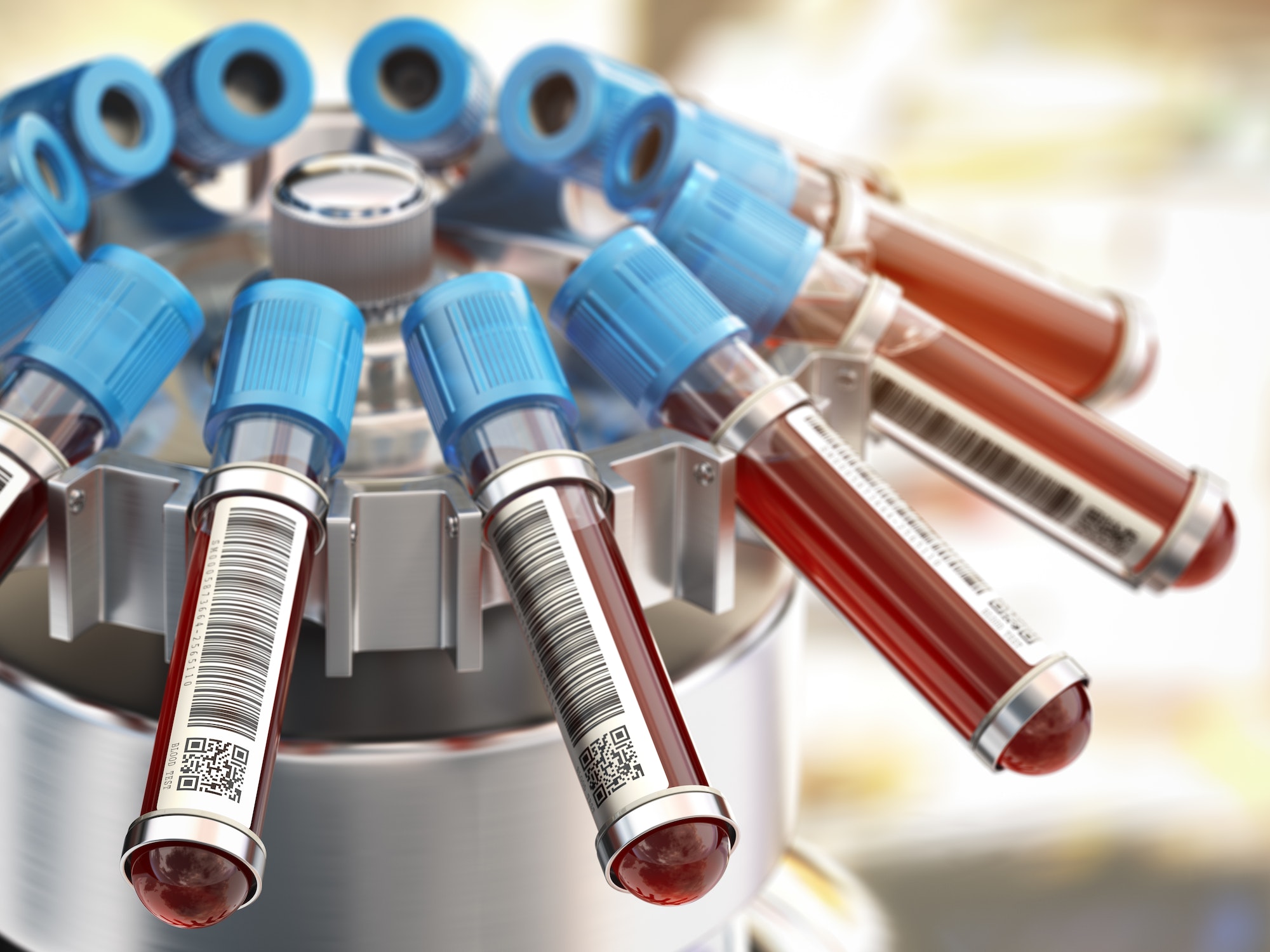 Weighing Options for Early Detection of Colorectal Cancer