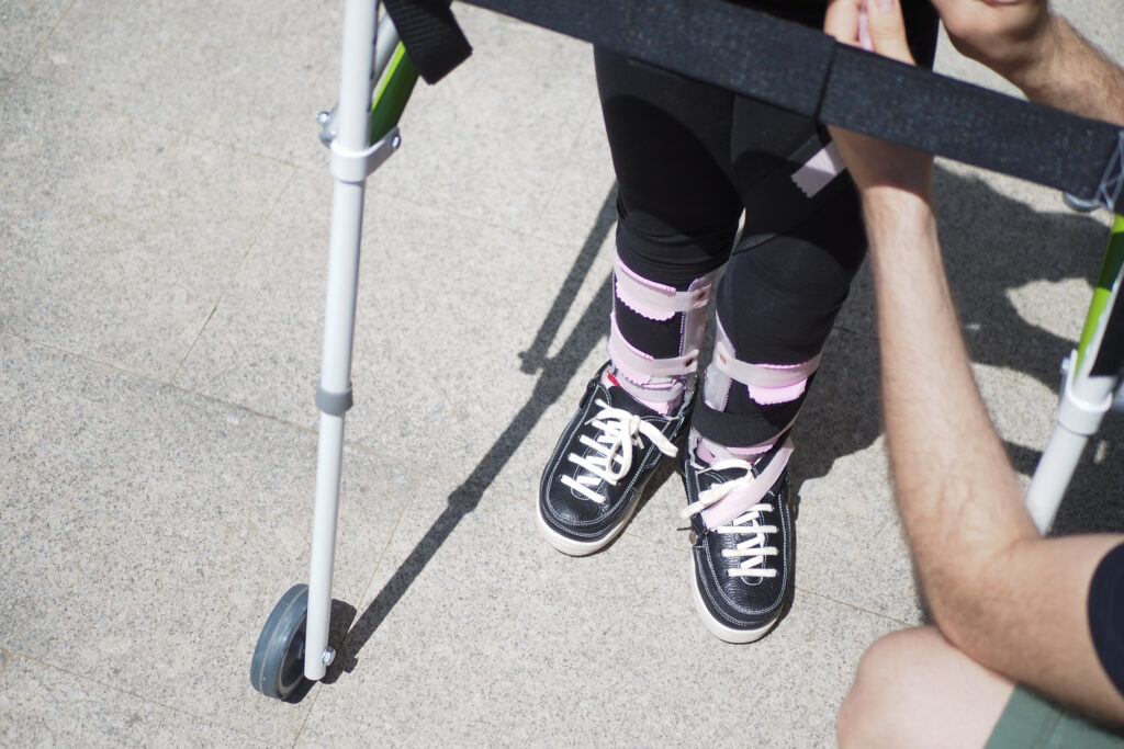 The Finer Details of Fractures