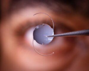 So You’ve Had a Lens Implant for Cataracts – What’s Next?